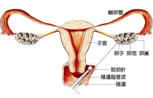 育儿爆款文案合集