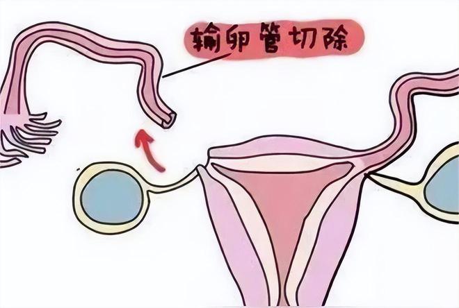 育儿教育