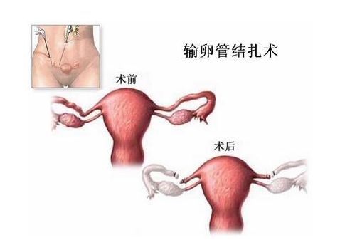 育儿知识3至6岁冬季