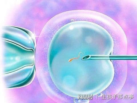 胎位不正