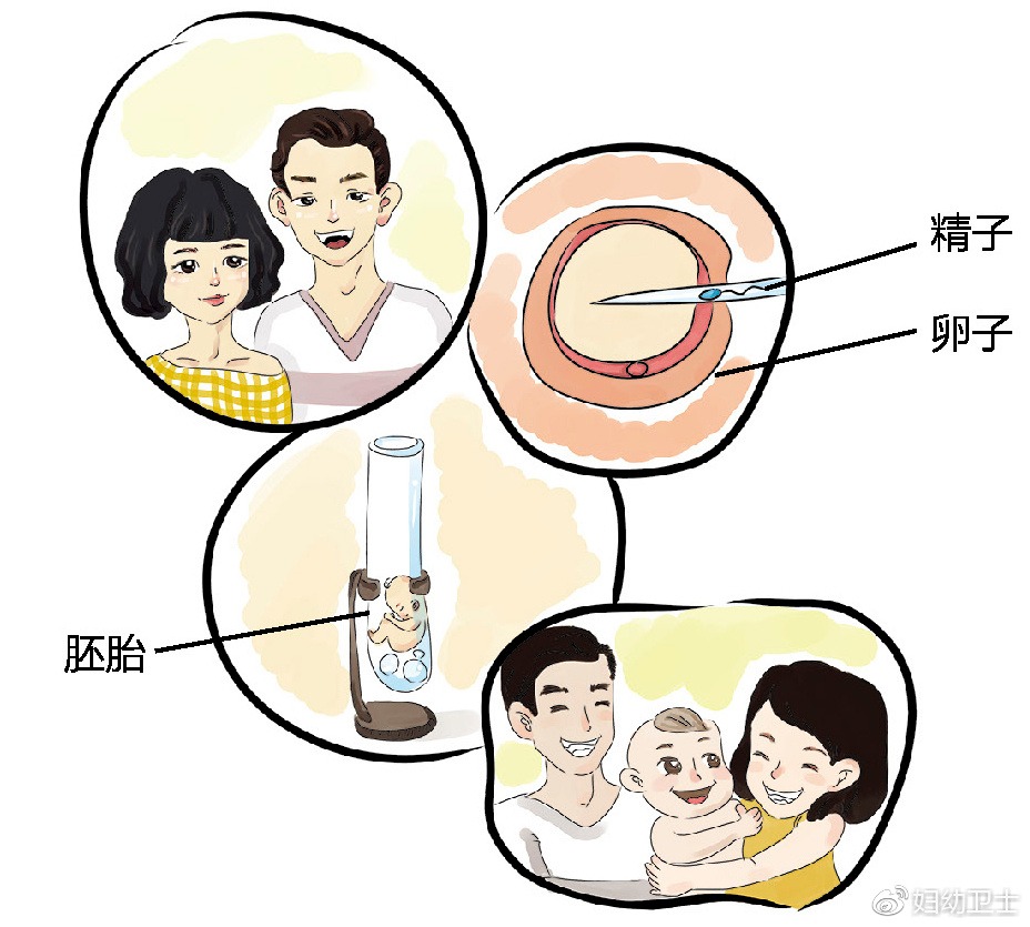 胎停育