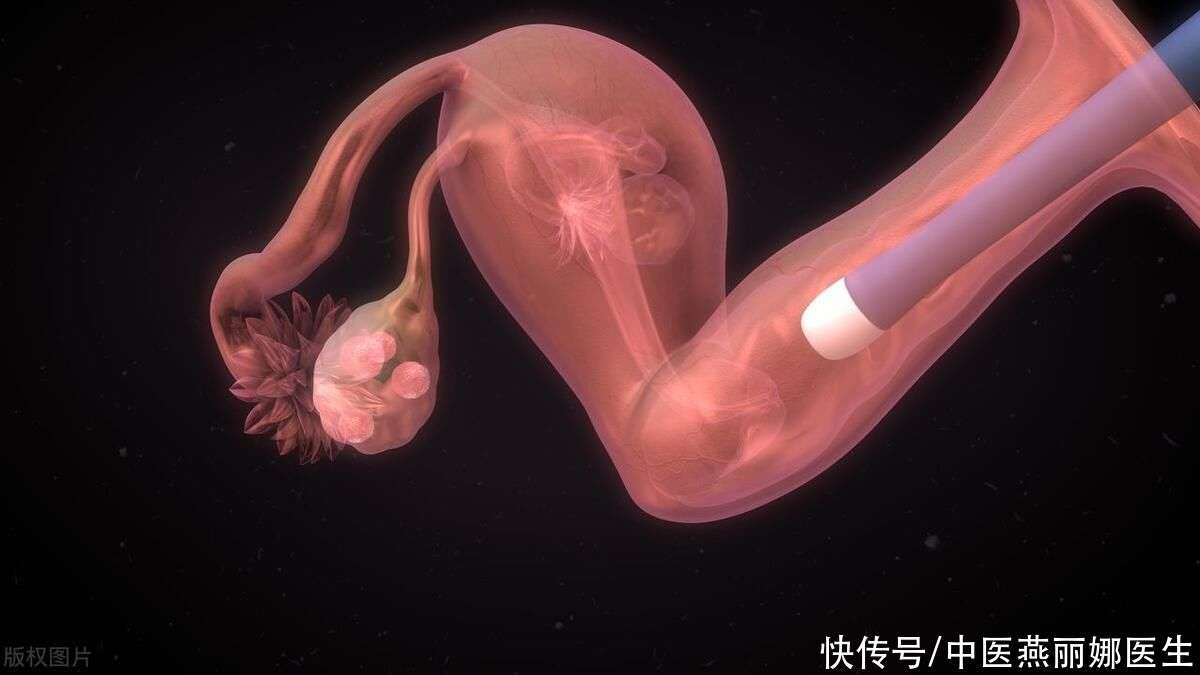 胎位不正