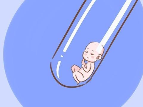 胎位横位