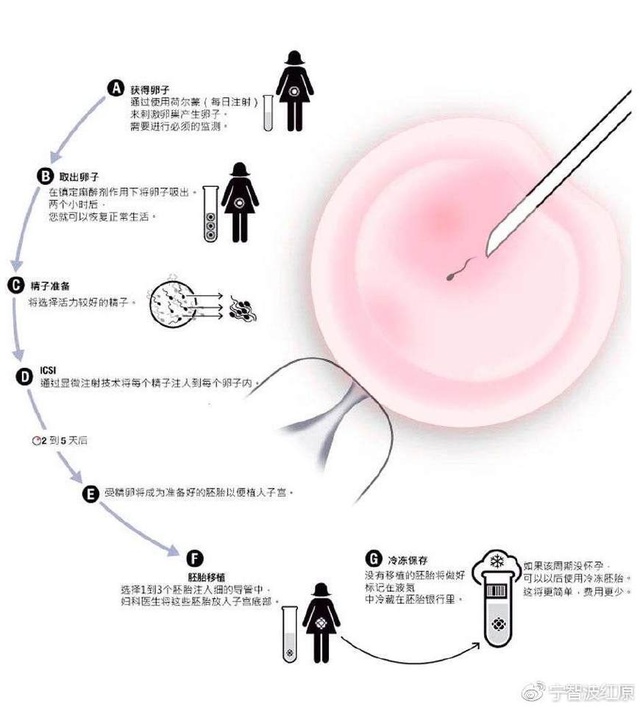 胎停