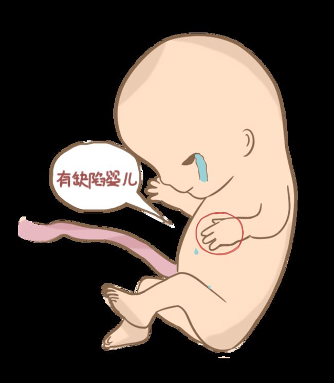胎位不正