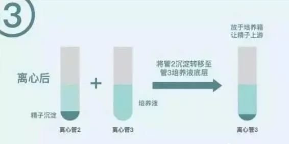 胎位不正