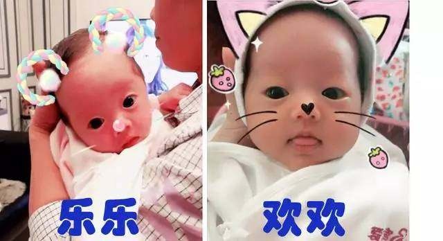 胎位不正