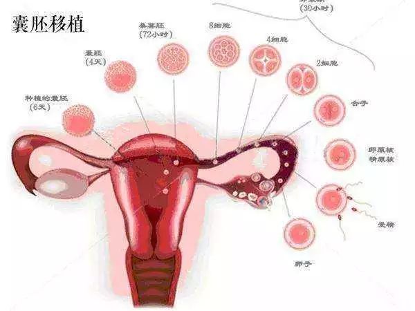 胎位不正