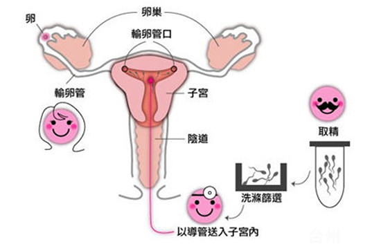 胎儿横位