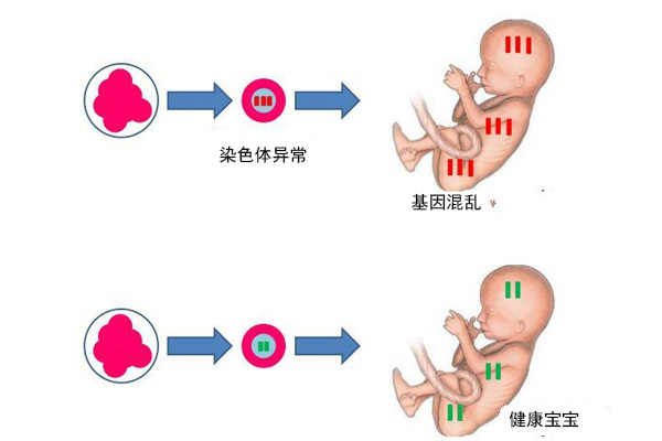 胎儿b超