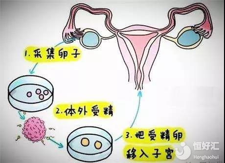胎停药流