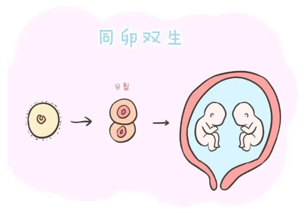 胎位不正