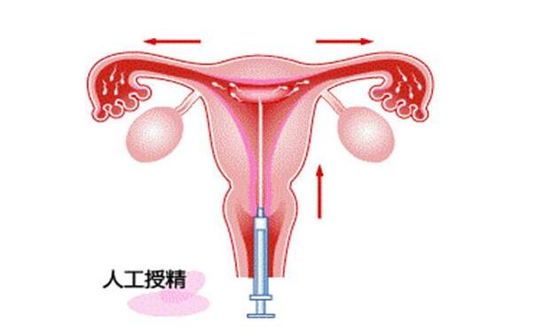 青岛试管婴儿